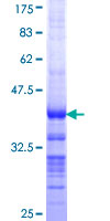 ab165515 on a 12.5% SDS-PAGE stained with Coomassie Blue.
