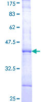 ab159300 on a 12.5% SDS-PAGE stained with Coomassie Blue.