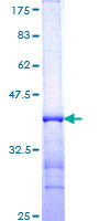 ab152655 on a 12.5% SDS-PAGE stained with Coomassie Blue.