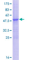 ab166345 on a 12.5% SDS-PAGE stained with Coomassie Blue.