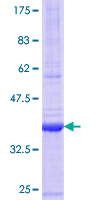 ab166346 on a 12.5% SDS-PAGE stained with Coomassie Blue.