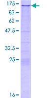 ab159306 on a 12.5% SDS-PAGE stained with Coomassie Blue.