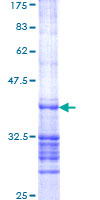 ab162655 on a 12.5% SDS-PAGE stained with Coomassie Blue.