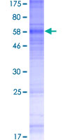 ab160313 on a 12.5% SDS-PAGE stained with Coomassie Blue.