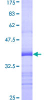 ab159307 on a 12.5% SDS-PAGE stained with Coomassie Blue.