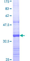 ab159308 on a 12.5% SDS-PAGE stained with Coomassie Blue.