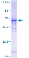 ab160595 on a 12.5% SDS-PAGE stained with Coomassie Blue.