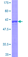 ab162959 on a 12.5% SDS-PAGE stained with Coomassie Blue.
