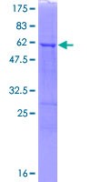 ab161475 on a 12.5% SDS-PAGE stained with Coomassie Blue.
