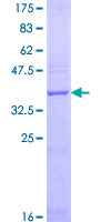 ab160915 on a 12.5% SDS-PAGE stained with Coomassie Blue.