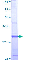 ab160916 on a 12.5% SDS-PAGE stained with Coomassie Blue.