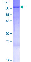 ab163605 on a 12.5% SDS-PAGE stained with Coomassie Blue.