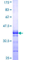 ab160190 on a 12.5% SDS-PAGE stained with Coomassie Blue.