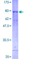 ab160648 on a 12.5% SDS-PAGE stained with Coomassie Blue.