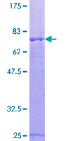 ab112419 analysed on a 12.5% SDS-PAGE gel stained with Coomassie Blue.