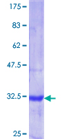 ab153454 on a 12.5% SDS-PAGE stained with Coomassie Blue.