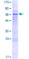 ab159312 on a 12.5% SDS-PAGE stained with Coomassie Blue.