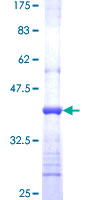ab159313 on a 12.5% SDS-PAGE stained with Coomassie Blue.