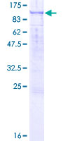 ab160027 on a 12.5% SDS-PAGE stained with Coomassie Blue.