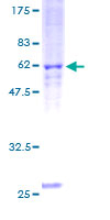 ab153238 on a 12.5% SDS-PAGE stained with Coomassie Blue.