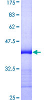 ab165697 on a 12.5% SDS-PAGE stained with Coomassie Blue.