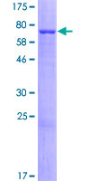 ab165958 on a 12.5% SDS-PAGE stained with Coomassie Blue.