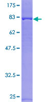 ab166046 on a 12.5% SDS-PAGE stained with Coomassie Blue.