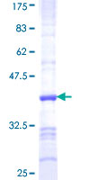 ab166047 on a 12.5% SDS-PAGE stained with Coomassie Blue.