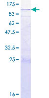ab153581 on a 12.5% SDS-PAGE stained with Coomassie Blue.