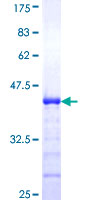 ab153582 on a 12.5% SDS-PAGE stained with Coomassie Blue.