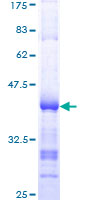 ab161778 on a 12.5% SDS-PAGE stained with Coomassie Blue.