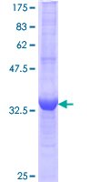 ab161779 on a 12.5% SDS-PAGE stained with Coomassie Blue.