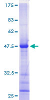 ab161085 on a 12.5% SDS-PAGE stained with Coomassie Blue.