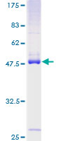 ab164866 on a 12.5% SDS-PAGE stained with Coomassie Blue.