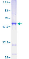 ab163945 on a 12.5% SDS-PAGE stained with Coomassie Blue.