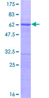 ab160647 on a 12.5% SDS-PAGE stained with Coomassie Blue.