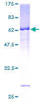 ab164467 on a 12.5% SDS-PAGE stained with Coomassie Blue.