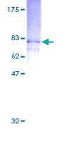 ab161358 on a 12.5% SDS-PAGE stained with Coomassie Blue.