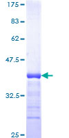 ab163649 on a 12.5% SDS-PAGE stained with Coomassie Blue.