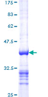 ab159318 on a 12.5% SDS-PAGE stained with Coomassie Blue.