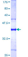 ab161073 on a 12.5% SDS-PAGE stained with Coomassie Blue.
