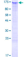 ab160706 on a 12.5% SDS-PAGE stained with Coomassie Blue.