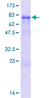 ab162981 on a 12.5% SDS-PAGE stained with Coomassie Blue.