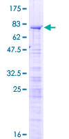 ab161508 on a 12.5% SDS-PAGE stained with Coomassie Blue.