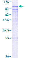 ab162859 on a 12.5% SDS-PAGE stained with Coomassie Blue.