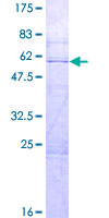 ab163121 on a 12.5% SDS-PAGE stained with Coomassie Blue.