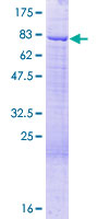 ab163996 on a 12.5% SDS-PAGE stained with Coomassie Blue.
