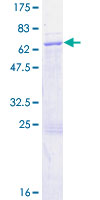ab164441 on a 12.5% SDS-PAGE stained with Coomassie Blue.