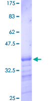 ab159320 on a 12.5% SDS-PAGE stained with Coomassie Blue.