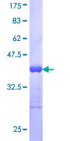 ab162134 on a 12.5% SDS-PAGE stained with Coomassie Blue.